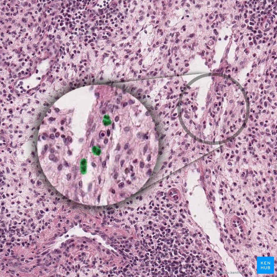 Mast cell (Mastocytus); Image: 