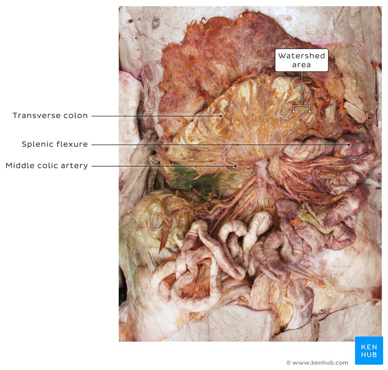 Colon and arteries in a cadaver