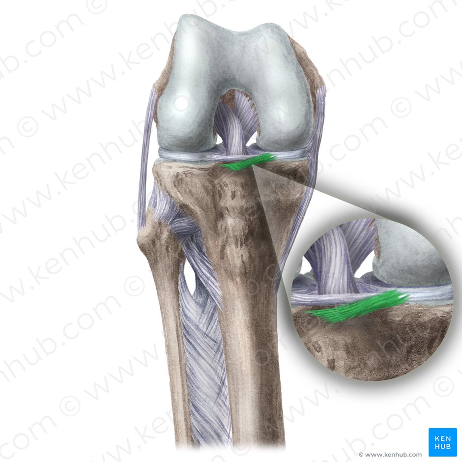 Ligamento meniscotibial anterior (Ligamentum meniscotibiale anterius); Imagen: Liene Znotina