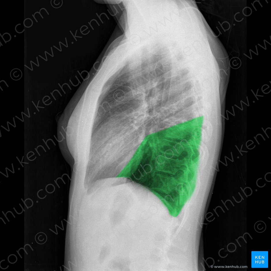 Inferior lobe of right lung (Lobus inferior pulmonis dextri); Image: 