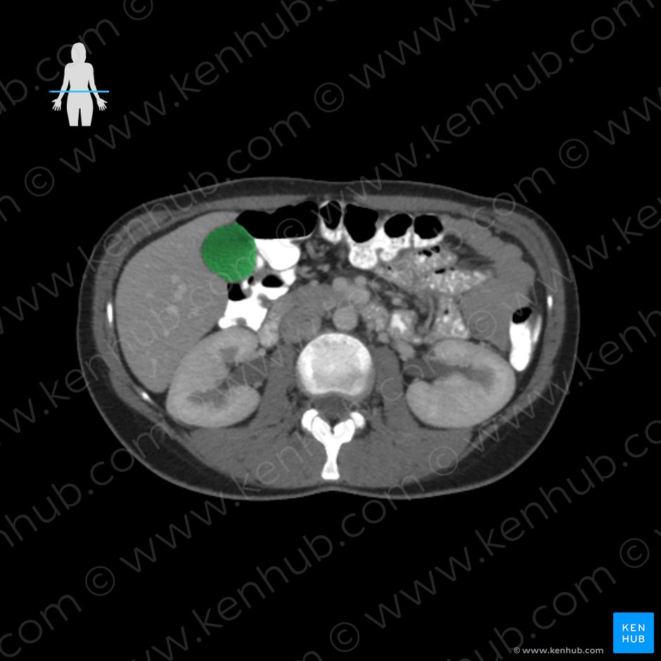 Gallbladder (Vesica biliaris); Image: 