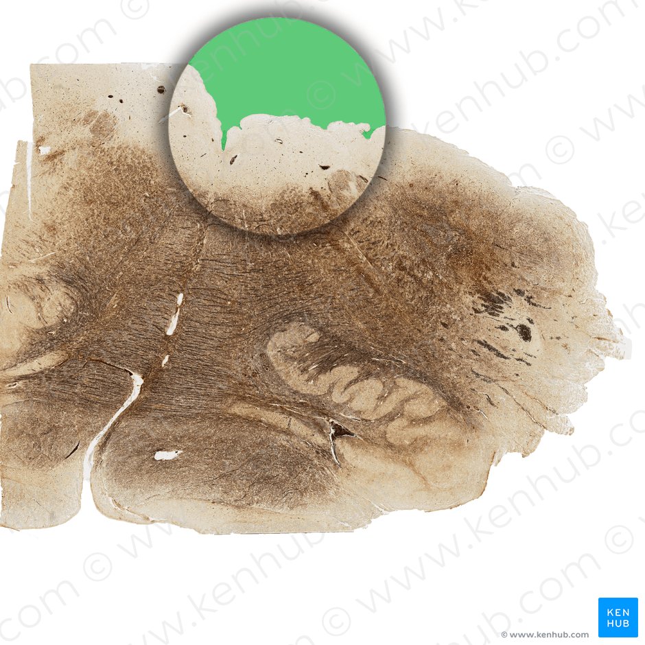Fourth ventricle (Ventriculus quartus); Image: 