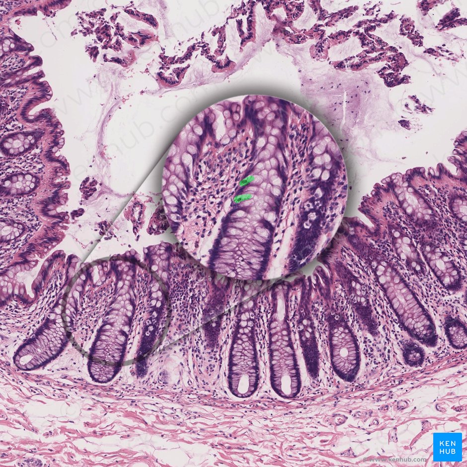 Enteroendocrine cell (Endocrinocytus gastrointestinalis); Image: 