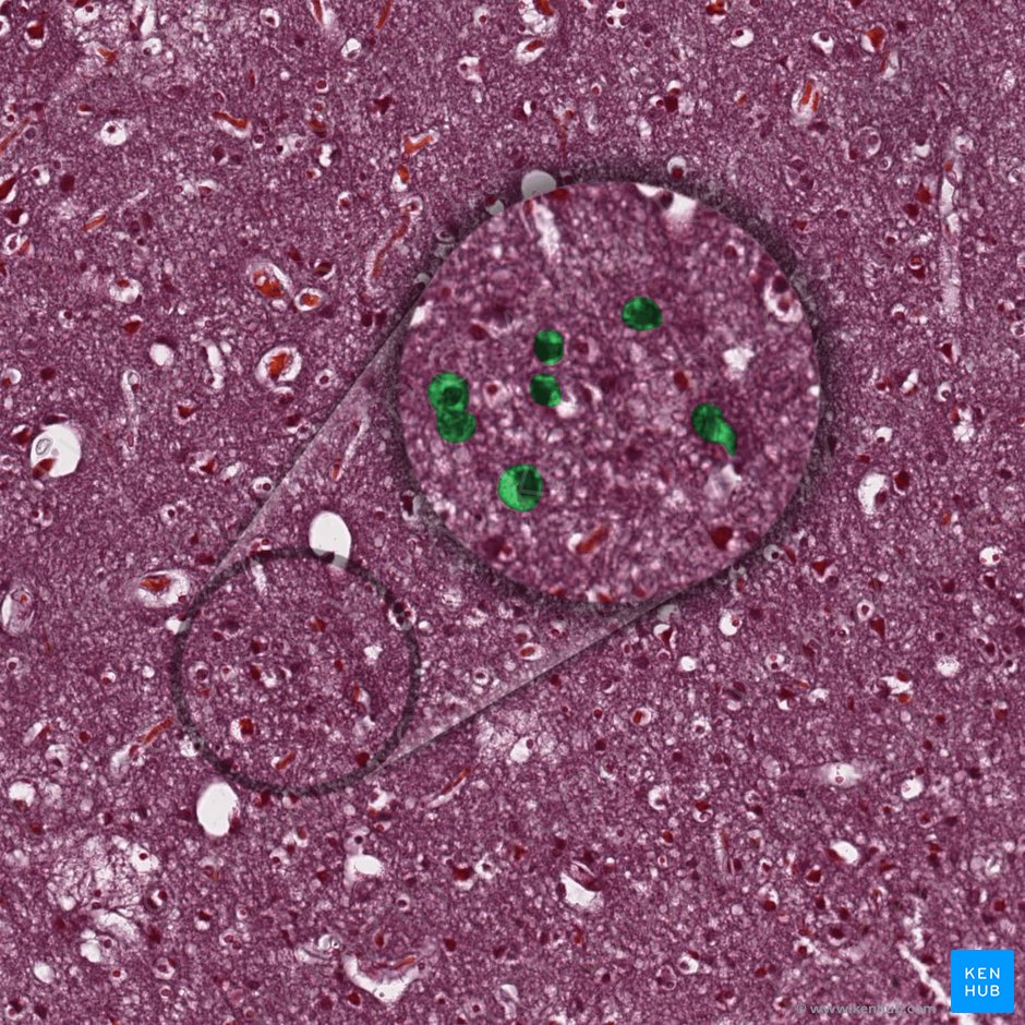 Neurofibrae (Neurone); Bild: 