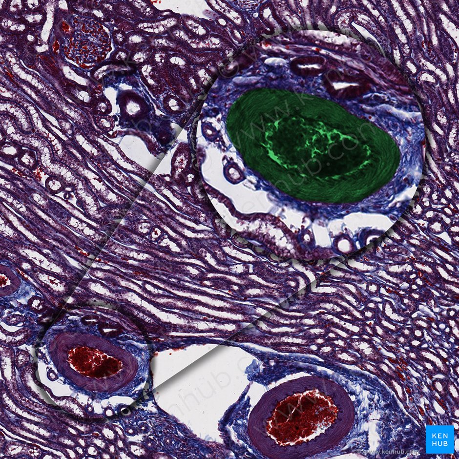 Interlobular artery (Arteria interlobularis); Image: 