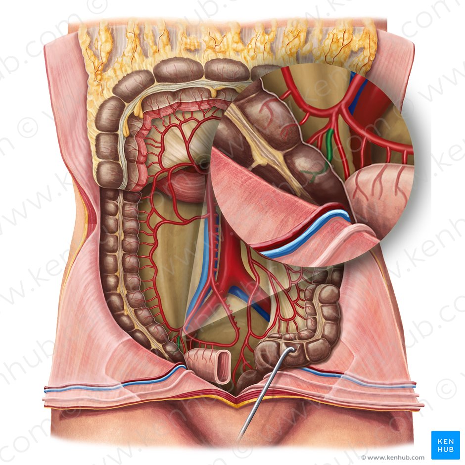 Anterior cecal artery (Arteria caecalis anterior); Image: Irina Münstermann