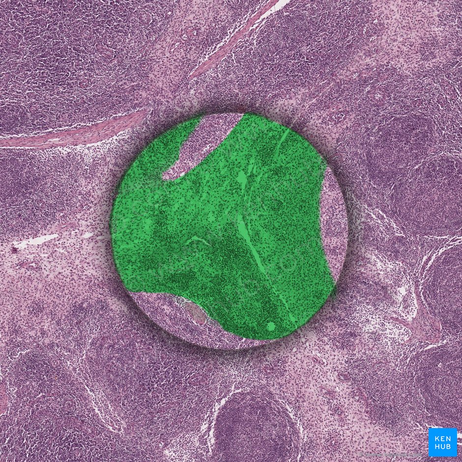 Reticular connective tissue; Image: 