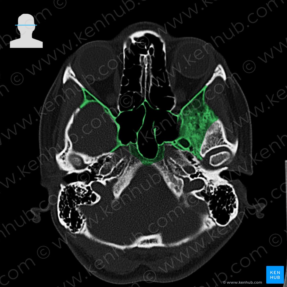 Sphenoid bone (Os sphenoidale); Image: 