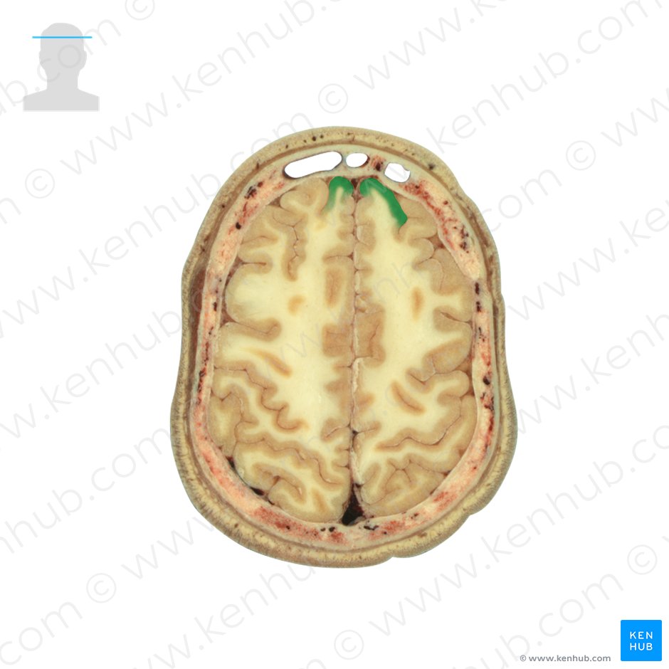 Superior frontal gyrus (Gyrus frontalis superior); Image: National Library of Medicine