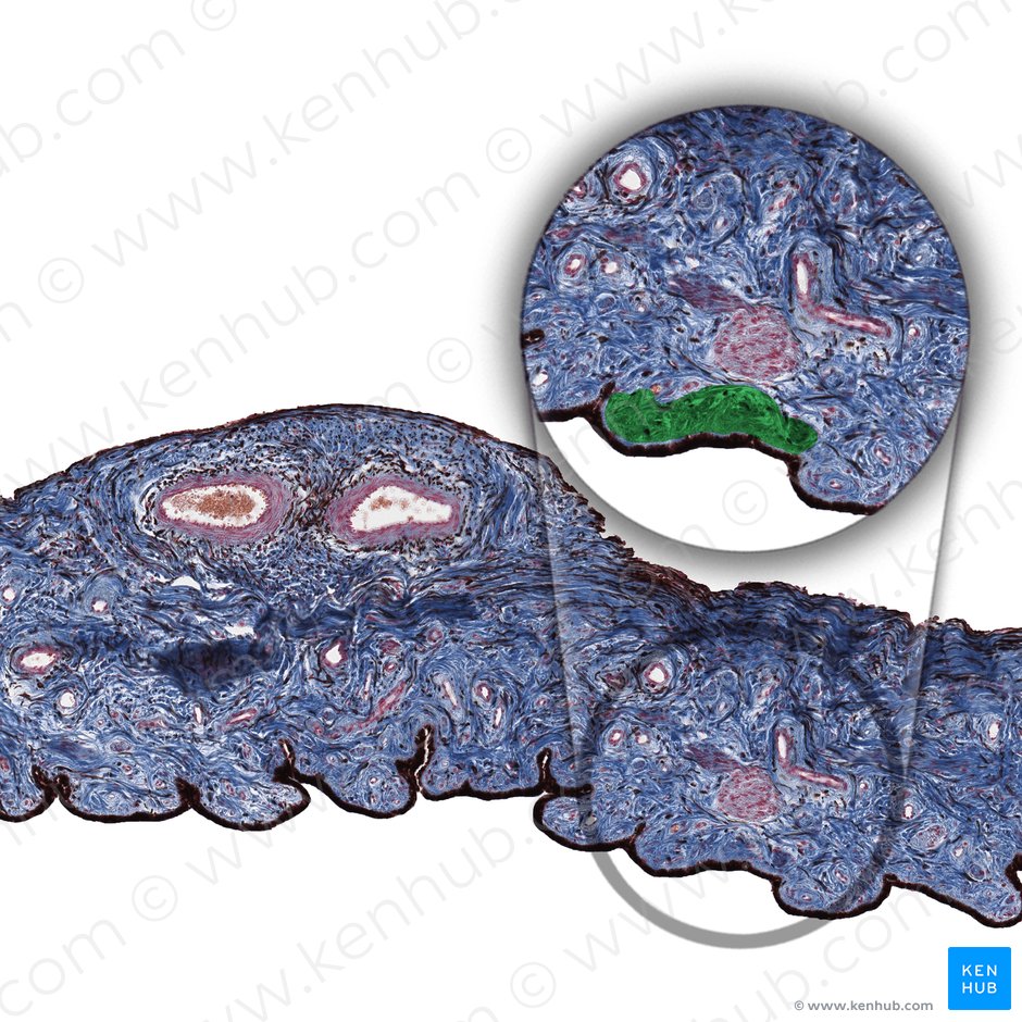 Dilator pupillae muscle of iris (Musculus dilatator pupillae iridis); Image: 