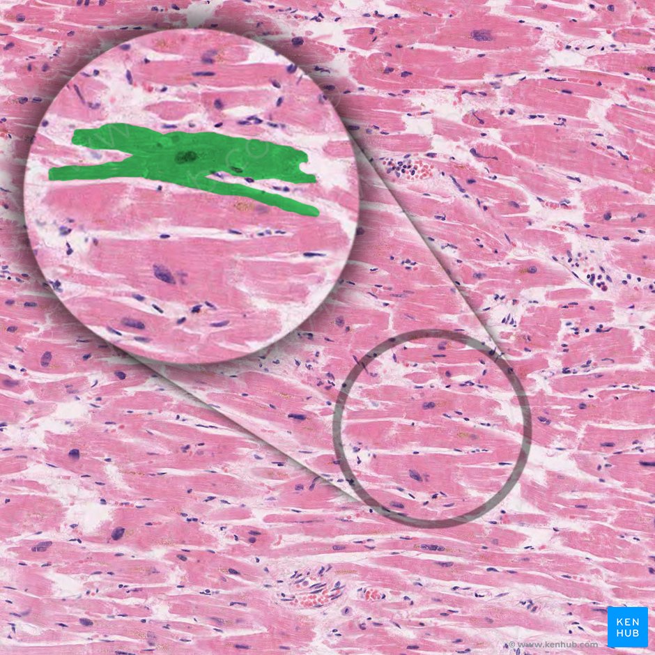 Cardiomiocito ramificado (Cardiomyocytus ramosus); Imagen: 