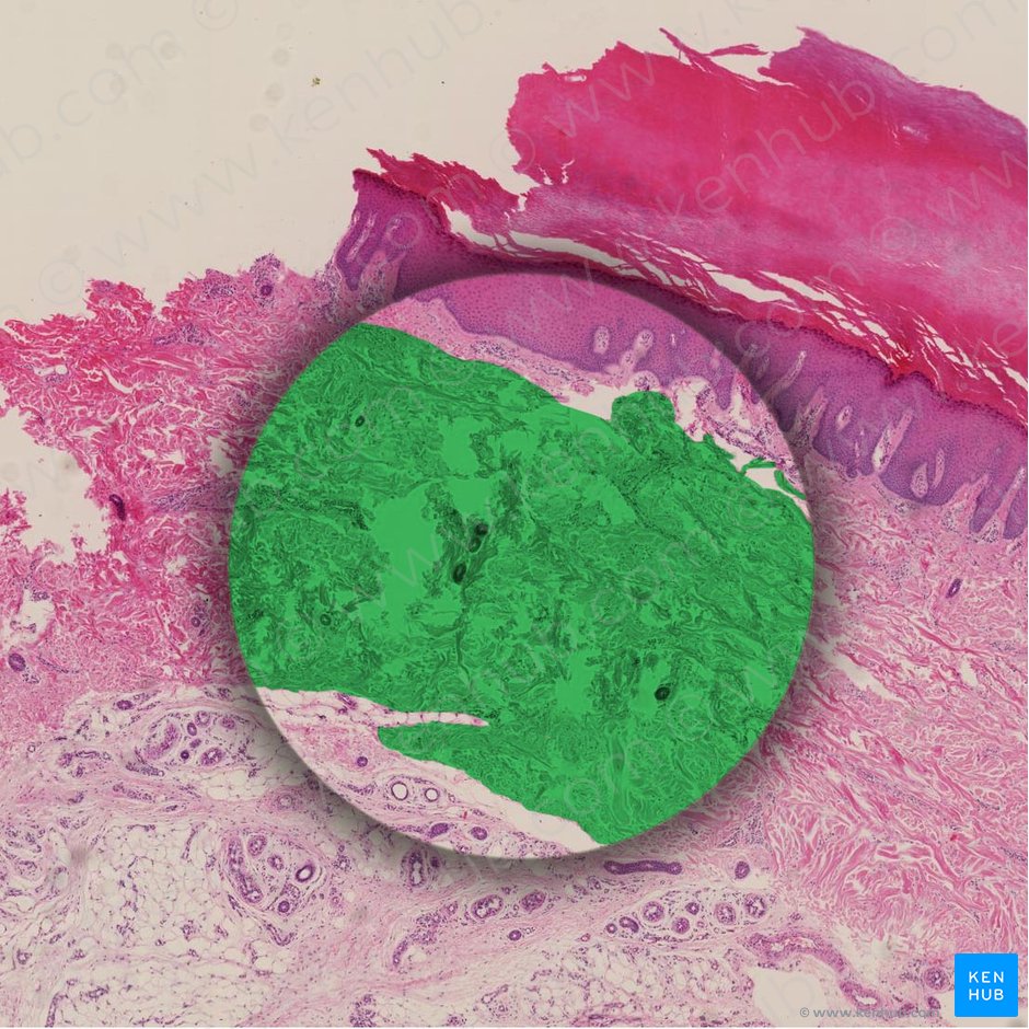 Reticular layer of dermis (Stratum reticulare dermis); Image: 